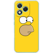 Чохол BoxFace Honor 400 Lite 