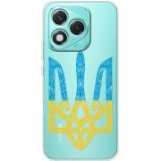 Прозорий чохол BoxFace Honor 400 Lite Gold Trident