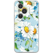 Чохол BoxFace Honor 400 Pro 