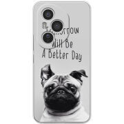 Чохол BoxFace Honor 400 Pro 