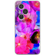 Чохол BoxFace Honor 400 Pro 