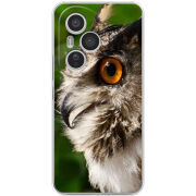 Чохол BoxFace Honor 400 Pro 