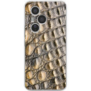 Чохол BoxFace Honor 400 Pro 