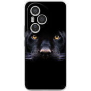 Чохол BoxFace Honor 400 Pro 