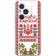 Чохол BoxFace Honor 400 Pro 