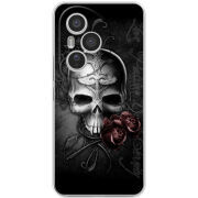 Чохол BoxFace Honor 400 Pro 