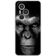 Чохол BoxFace Honor 400 Pro 