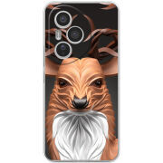 Чохол BoxFace Honor 400 Pro 