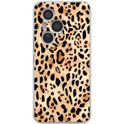 Чохол BoxFace Honor 400 Pro 