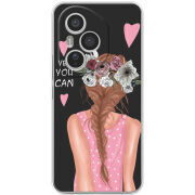 Чохол BoxFace Honor 400 Pro You Can