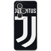 Чохол BoxFace Honor 400 Pro FC J