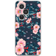 Чохол BoxFace Honor 400 Pro 