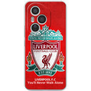 Чохол BoxFace Honor 400 Pro 