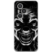 Чохол BoxFace Honor 400 Pro 