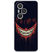 Чохол BoxFace Honor 400 Pro 