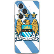 Чохол BoxFace Honor 400 Pro 