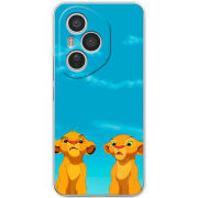 Чохол BoxFace Honor 400 Pro 