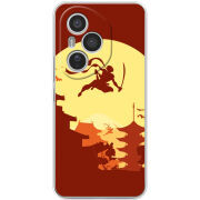 Чохол BoxFace Honor 400 Pro 