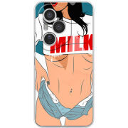 Чохол BoxFace Honor 400 Pro 