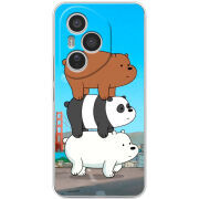 Чохол BoxFace Honor 400 Pro 