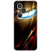 Чохол BoxFace Honor 400 Pro 