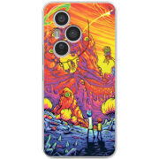 Чохол BoxFace Honor 400 Pro 