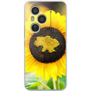 Чохол BoxFace Honor 400 Pro 