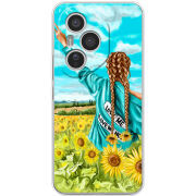 Чохол BoxFace Honor 400 Pro Love Me, Love Me Not