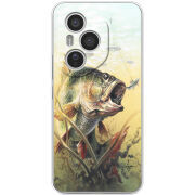 Чохол BoxFace Honor 400 Pro 