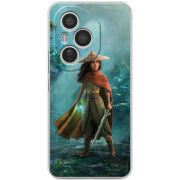 Чохол BoxFace Honor 400 Pro Raya