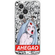 Чохол BoxFace Honor 400 Pro Ahegao