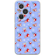 Чохол BoxFace Honor 400 Pro 