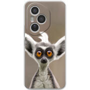 Чохол BoxFace Honor 400 Pro 