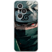 Чохол BoxFace Honor 400 Pro Какаши Хатаке