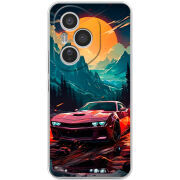 Чохол BoxFace Honor 400 Pro 