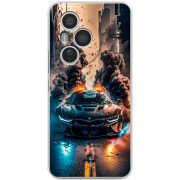 Чохол BoxFace Honor 400 Pro 