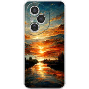 Чохол BoxFace Honor 400 Pro 