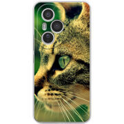 Чохол BoxFace Honor 400 Pro 