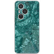 Чохол BoxFace Honor 400 Pro 