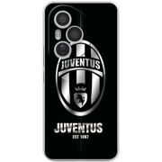 Чохол BoxFace Honor 400 Pro 