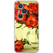 Чохол BoxFace Honor 400 Pro 