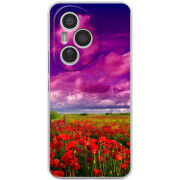 Чохол BoxFace Honor 400 Pro 