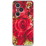 Чохол BoxFace Honor 400 Pro 