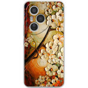 Чохол BoxFace Honor 400 Pro 