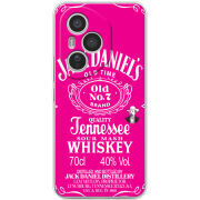 Чохол BoxFace Honor 400 Pro 