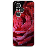 Чохол BoxFace Honor 400 Pro 