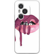 Чохол BoxFace Honor 400 Pro 