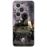 Чохол BoxFace Honor 400 Pro 