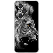 Чохол BoxFace Honor 400 Pro 