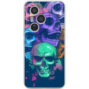 Чохол BoxFace Honor 400 Pro 